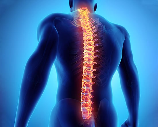 Lumbar Fusion | Modern Spine